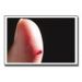 WoundCare
